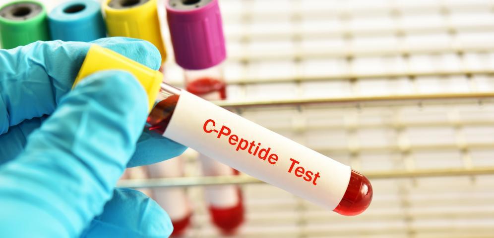 C-Peptide Reagent